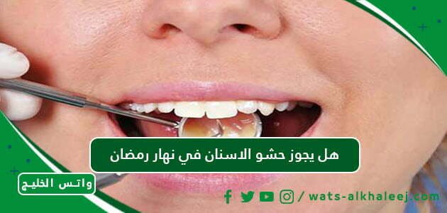 هل يجوز حشو الاسنان في نهار رمضان